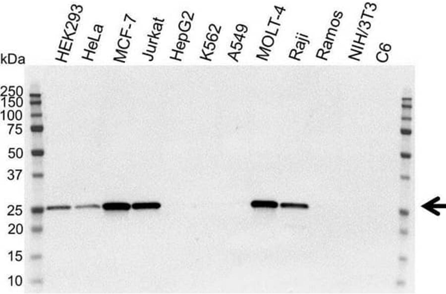 Western Blot - Anti-Bcl-2 Antibody [100] (A278770) - Antibodies.com