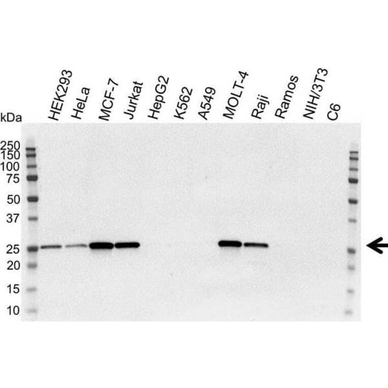 Western Blot - Anti-Bcl-2 Antibody [100] (A278770) - Antibodies.com