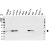 Western Blot - Anti-Bcl-2 Antibody [100] (A278770) - Antibodies.com