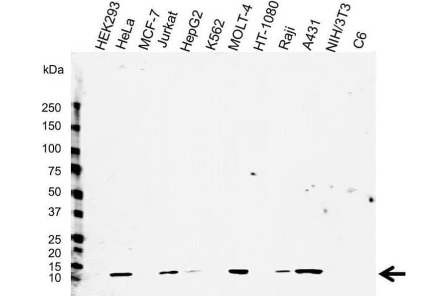 Western Blot - Anti-beta 2 Microglobulin Antibody [2213] (A278807) - Antibodies.com