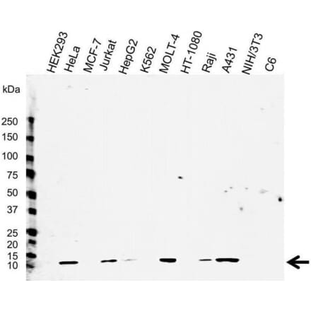 Western Blot - Anti-beta 2 Microglobulin Antibody [2213] (A278807) - Antibodies.com
