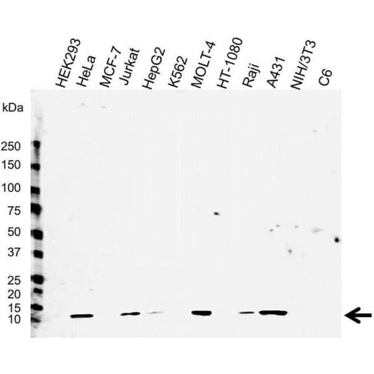Western Blot - Anti-beta 2 Microglobulin Antibody [2213] (A278807) - Antibodies.com