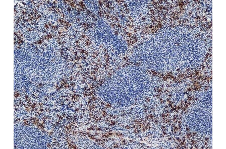 Immunohistochemistry - Anti-Ly-6B.2 Alloantigen Antibody [7/4] (A278854) - Antibodies.com