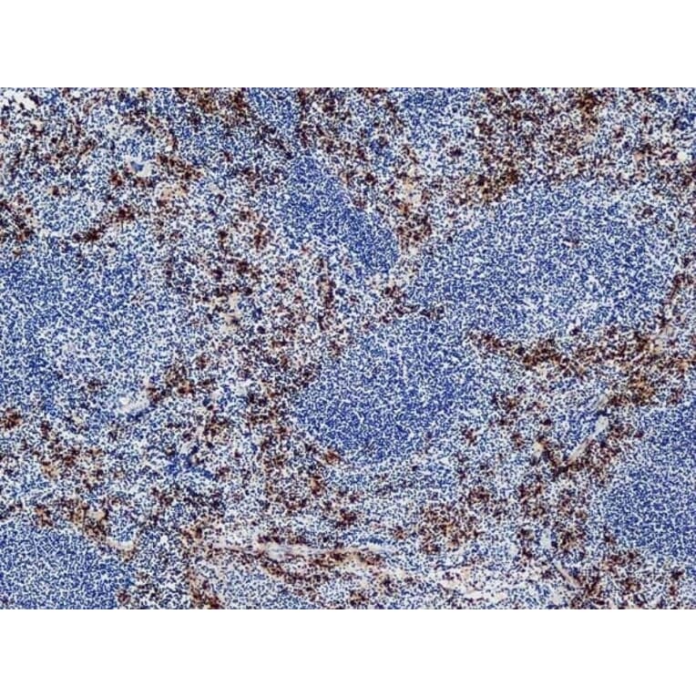 Immunohistochemistry - Anti-Ly-6B.2 Alloantigen Antibody [7/4] (A278854) - Antibodies.com