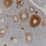 Immunohistochemistry - Anti-AMH Antibody [5/6] (A278857) - Antibodies.com