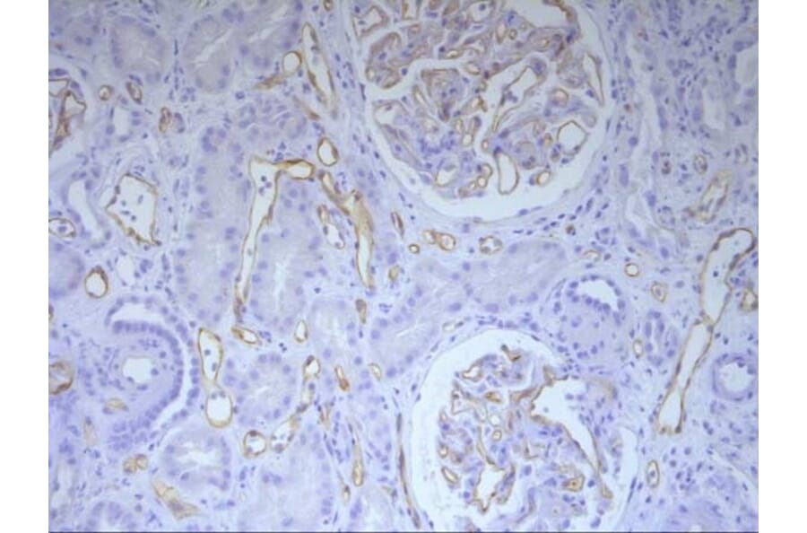 Immunohistochemistry - Anti-C4d Antibody [10-11] (A278859) - Antibodies.com
