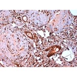 Immunohistochemistry - Anti-Estrogen Receptor beta 5 Antibody [5/25] (A278864) - Antibodies.com