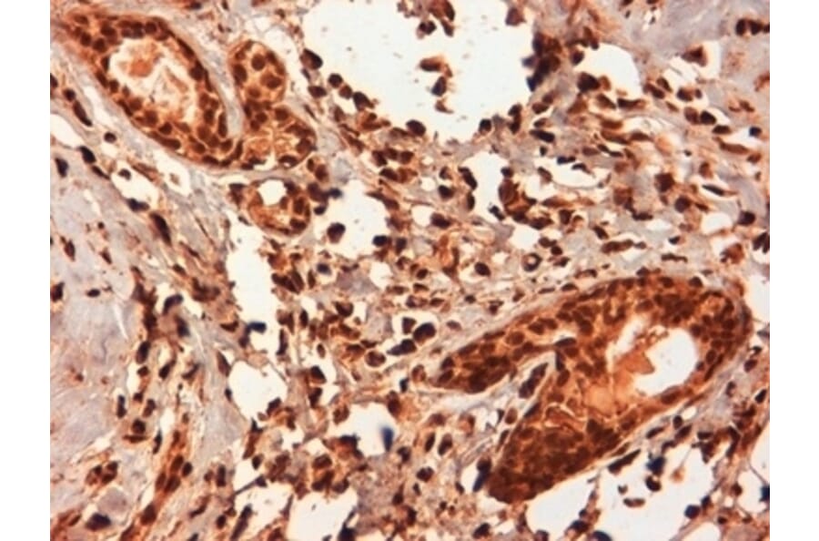 Immunohistochemistry - Anti-Estrogen Receptor beta 5 Antibody [5/25] (A278864) - Antibodies.com