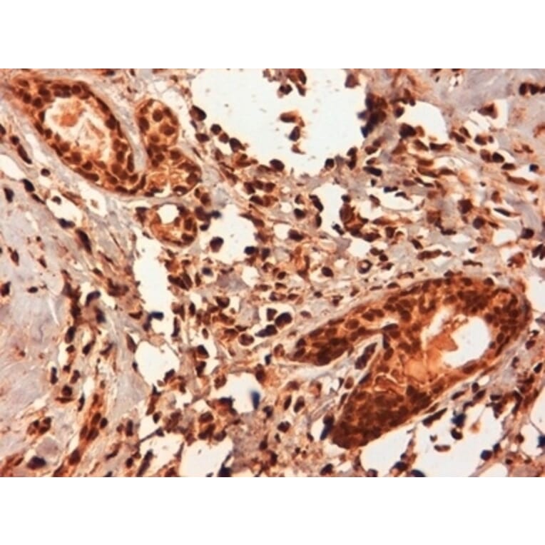 Immunohistochemistry - Anti-Estrogen Receptor beta 5 Antibody [5/25] (A278864) - Antibodies.com