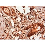Immunohistochemistry - Anti-Estrogen Receptor beta 5 Antibody [5/25] (A278864) - Antibodies.com