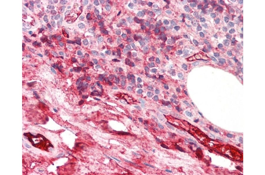 Immunohistochemistry - Anti-iC3b Antibody [013III-1.16] (A278894) - Antibodies.com