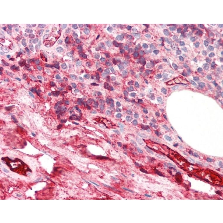 Immunohistochemistry - Anti-iC3b Antibody [013III-1.16] (A278894) - Antibodies.com