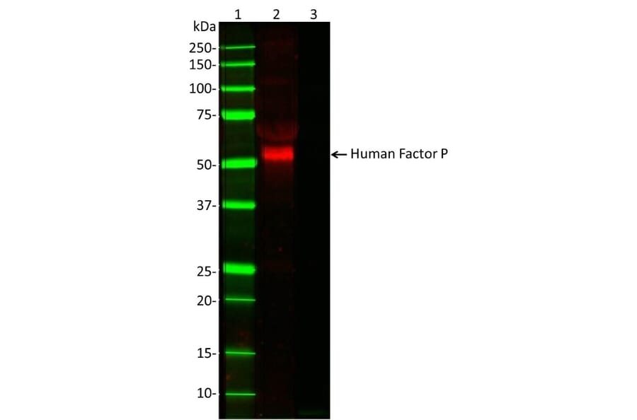 Western Blot - Anti-Properdin / PFC Antibody [062-27.8.1 (10-18)] (A278912) - Antibodies.com