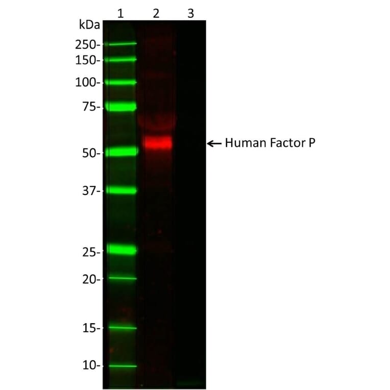 Western Blot - Anti-Properdin / PFC Antibody [062-27.8.1 (10-18)] (A278912) - Antibodies.com