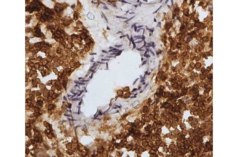 Immunohistochemistry - Anti-CD45 Antibody [1.11.32] (A278918) - Antibodies.com