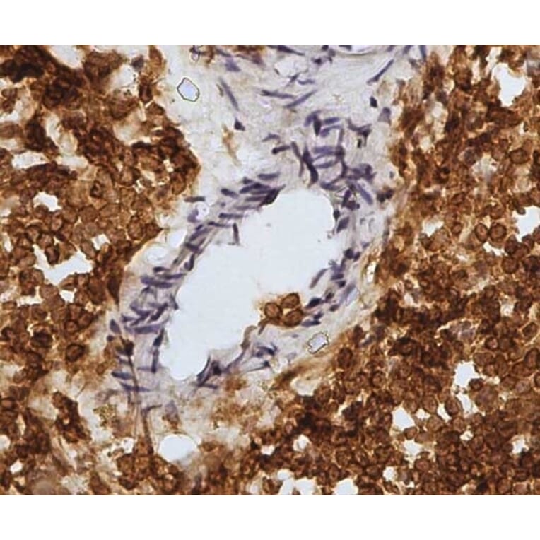 Immunohistochemistry - Anti-CD45 Antibody [1.11.32] (A278918) - Antibodies.com