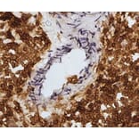 Immunohistochemistry - Anti-CD45 Antibody [1.11.32] (A278918) - Antibodies.com