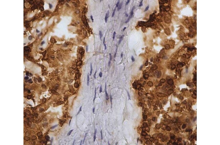 Immunohistochemistry - Anti-CD45 Antibody [1.11.32] (A278918) - Antibodies.com