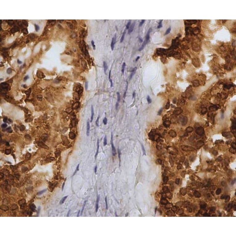 Immunohistochemistry - Anti-CD45 Antibody [1.11.32] (A278918) - Antibodies.com