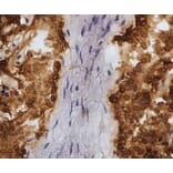 Immunohistochemistry - Anti-CD45 Antibody [1.11.32] (A278918) - Antibodies.com