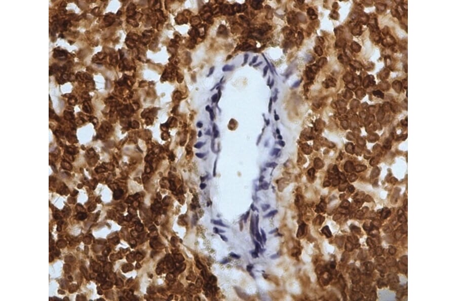Immunohistochemistry - Anti-CD45 Antibody [1.11.32] (A278918) - Antibodies.com