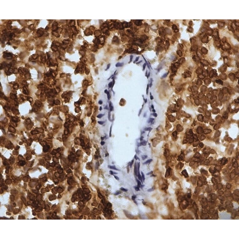 Immunohistochemistry - Anti-CD45 Antibody [1.11.32] (A278918) - Antibodies.com