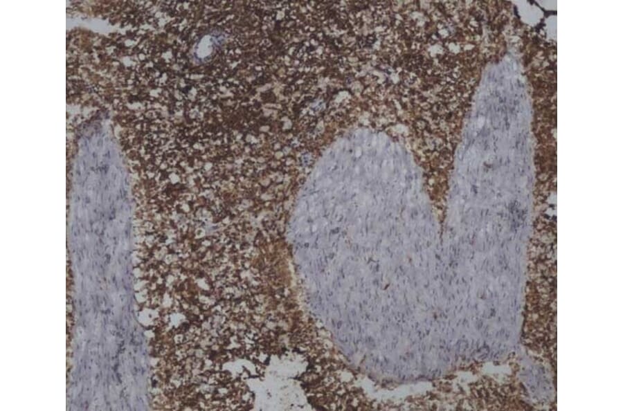 Immunohistochemistry - Anti-CD45 Antibody [1.11.32] (A278918) - Antibodies.com