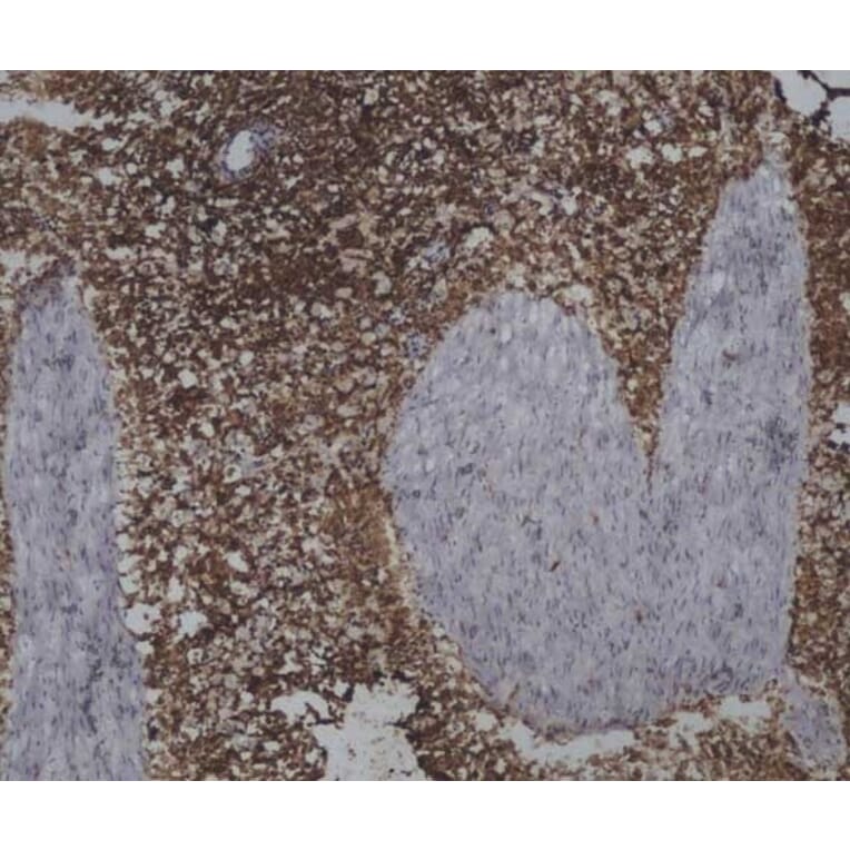 Immunohistochemistry - Anti-CD45 Antibody [1.11.32] (A278918) - Antibodies.com