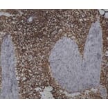 Immunohistochemistry - Anti-CD45 Antibody [1.11.32] (A278918) - Antibodies.com