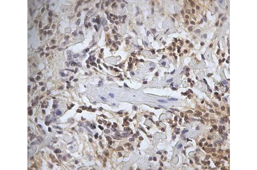 Immunohistochemistry - Anti-CD45 Antibody [1.11.32] (A278918) - Antibodies.com