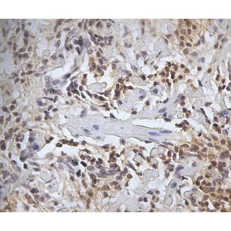 Immunohistochemistry - Anti-CD45 Antibody [1.11.32] (A278918) - Antibodies.com