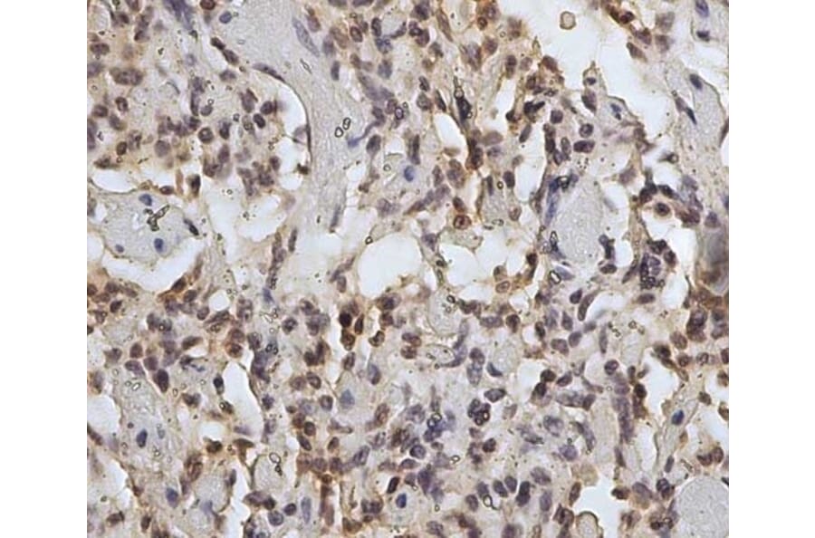 Immunohistochemistry - Anti-CD45 Antibody [1.11.32] (A278918) - Antibodies.com