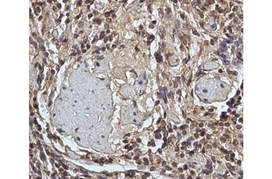 Immunohistochemistry - Anti-CD45 Antibody [1.11.32] (A278918) - Antibodies.com