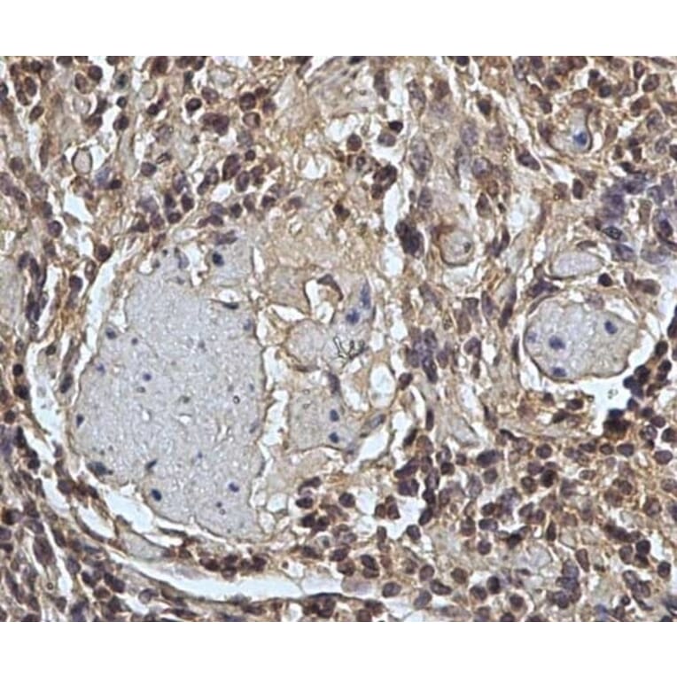 Immunohistochemistry - Anti-CD45 Antibody [1.11.32] (A278918) - Antibodies.com