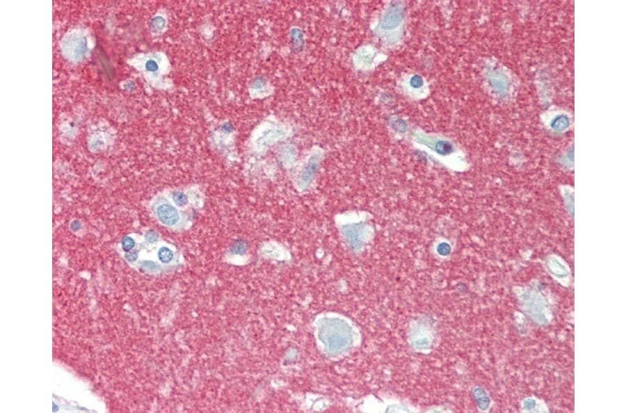 Immunohistochemistry - Anti-NCAM1 Antibody [123C3] (A278980) - Antibodies.com