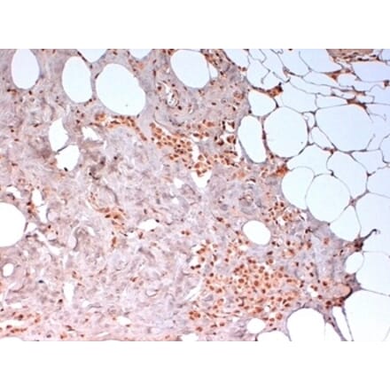 Immunohistochemistry - Anti-N-Cadherin Antibody [13A9] (A279008) - Antibodies.com