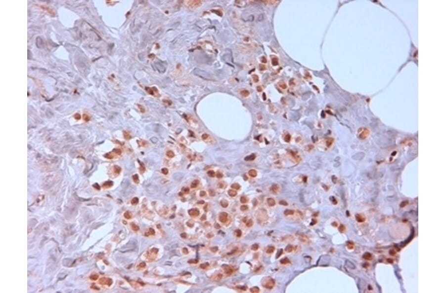 Immunohistochemistry - Anti-N-Cadherin Antibody [13A9] (A279008) - Antibodies.com