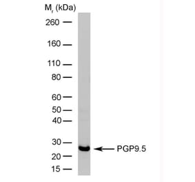 Western Blot - Anti-PGP9.5 Antibody [13C4] (A279009) - Antibodies.com