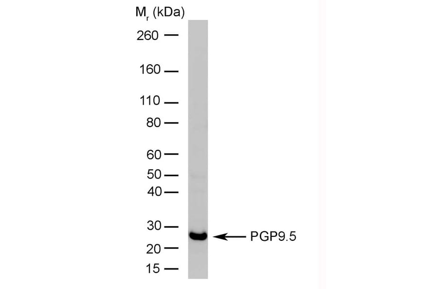 Western Blot - Anti-PGP9.5 Antibody [13C4] (A279009) - Antibodies.com