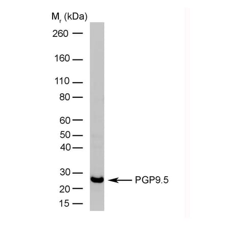 Western Blot - Anti-PGP9.5 Antibody [13C4] (A279009) - Antibodies.com