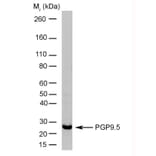 Western Blot - Anti-PGP9.5 Antibody [13C4] (A279009) - Antibodies.com