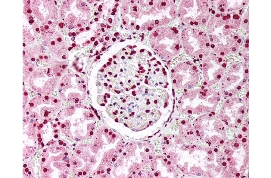 Immunohistochemistry - Anti-Nuclear Antigen Antibody [1415-1 (21NC85)] (A279010) - Antibodies.com