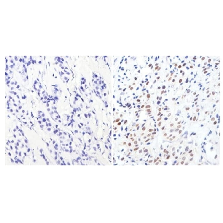 Immunohistochemistry - Anti-GATA3 Antibody [1A12-1D9] (A279065) - Antibodies.com