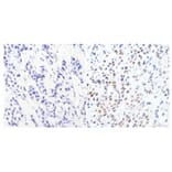 Immunohistochemistry - Anti-GATA3 Antibody [1A12-1D9] (A279065) - Antibodies.com