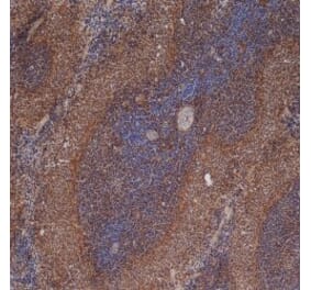 Immunohistochemistry - Anti-ICAM1 Antibody [1A29] (A279069) - Antibodies.com