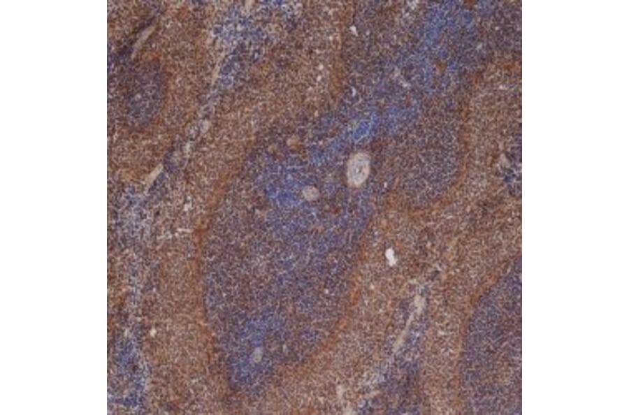 Immunohistochemistry - Anti-ICAM1 Antibody [1A29] (A279069) - Antibodies.com