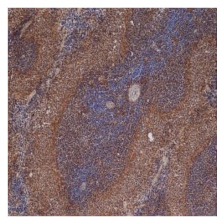 Immunohistochemistry - Anti-ICAM1 Antibody [1A29] (A279069) - Antibodies.com
