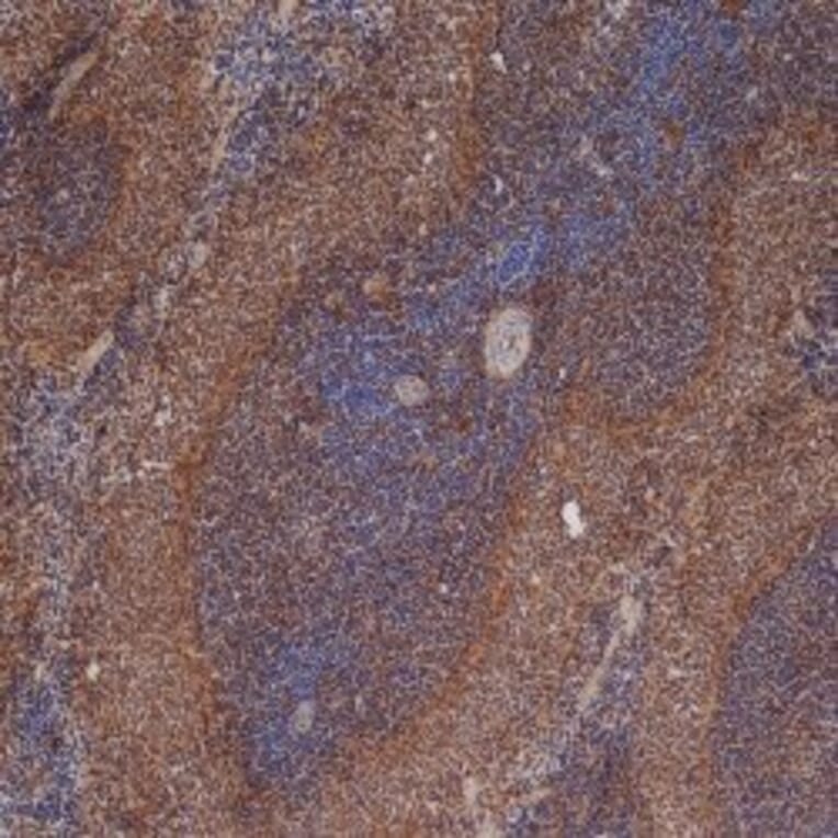 Immunohistochemistry - Anti-ICAM1 Antibody [1A29] (A279069) - Antibodies.com