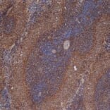 Immunohistochemistry - Anti-ICAM1 Antibody [1A29] (A279069) - Antibodies.com