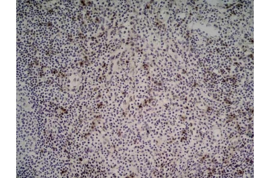 Immunohistochemistry - Anti-NKG2D Antibody [1D11] (A279090) - Antibodies.com